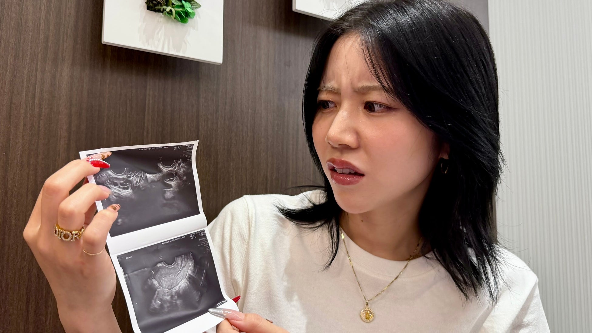 くれいじーまぐねっとUraN、婦人科検診で子宮筋腫が見つかったことを公表